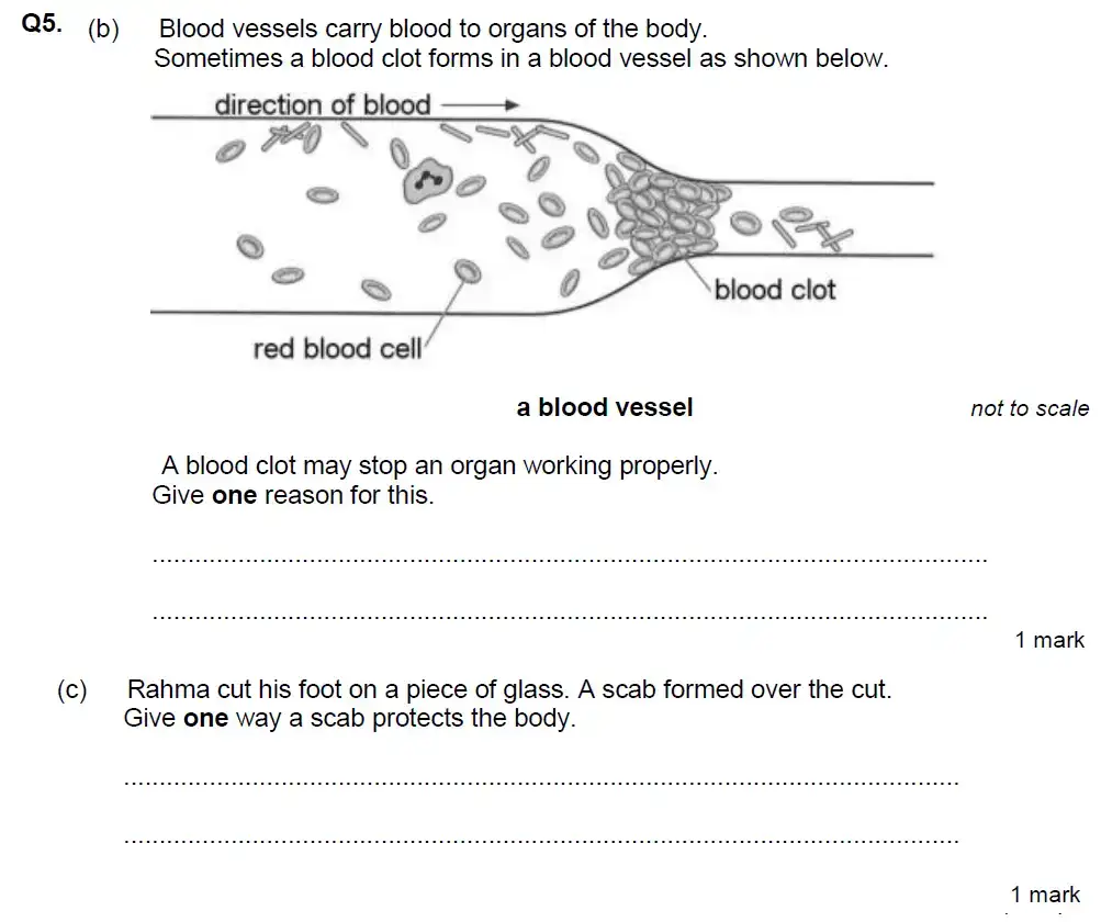 Question 15 - Aldenham School - 13 Plus Biology Exam Paper 2020