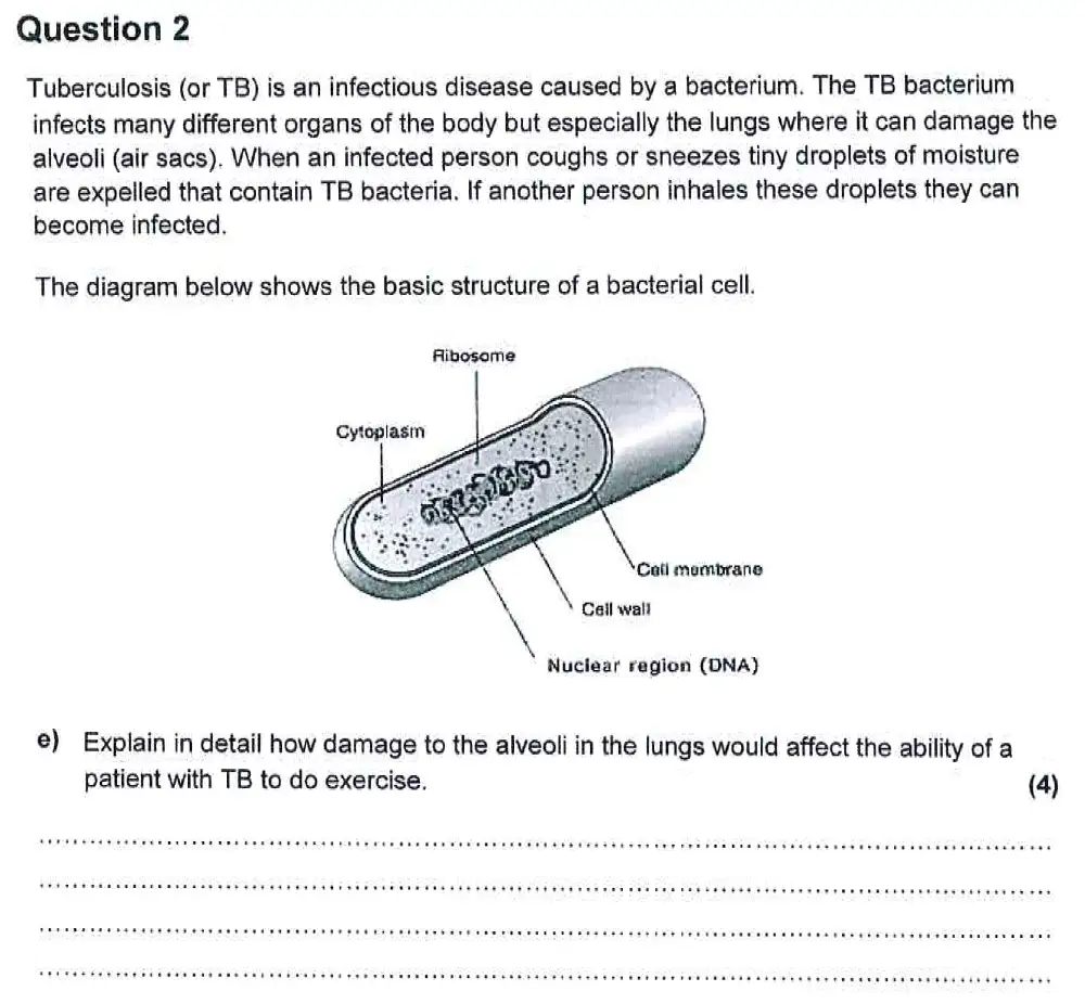Question 10 - Harrow School - 13 Plus Biology Scholarship Sample Paper 2 - 2015