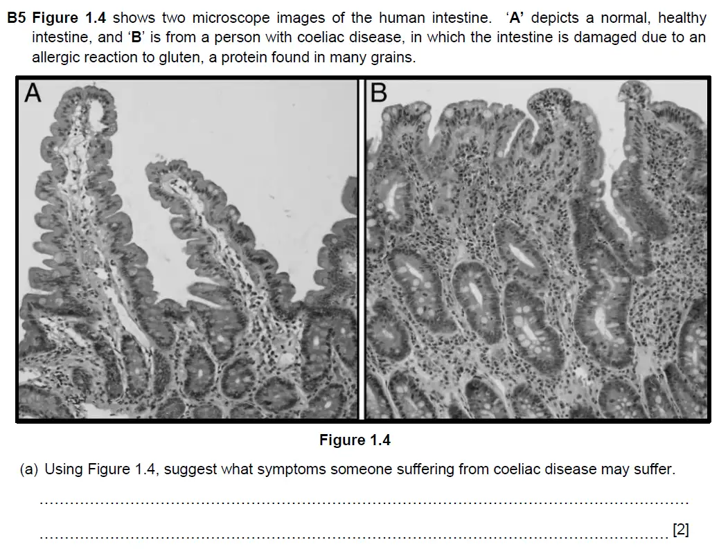 Question 13 - Westminster School - 13 Plus Biology Scholarship Exam Paper 2016