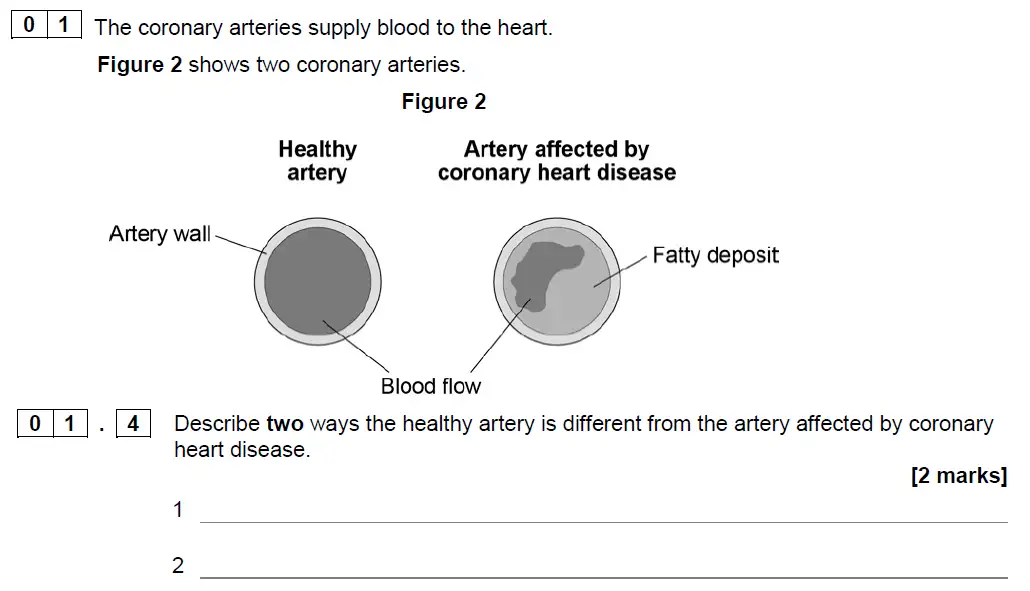 Question 4 - GCSE AQA Foundation Biology Specimen Paper 1