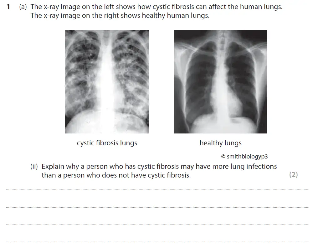 Question 2 - GCSE Edexcel Higher Biology Past Paper 1 - June 2017