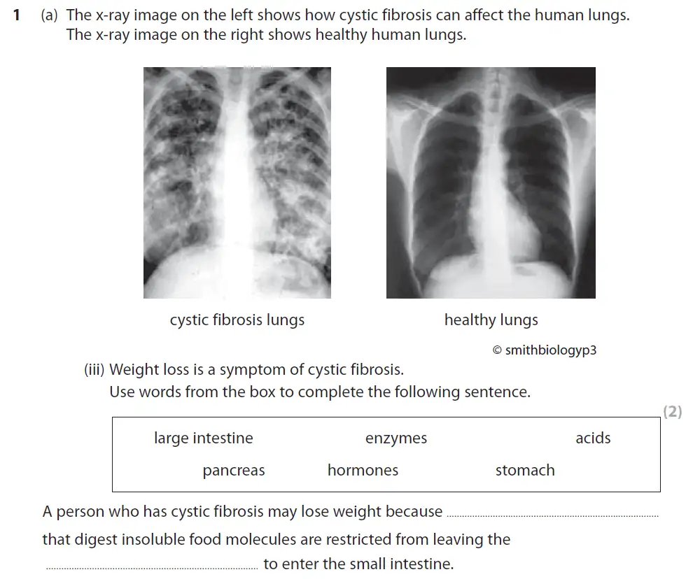Question 3 - GCSE Edexcel Higher Biology Past Paper 1 - June 2017
