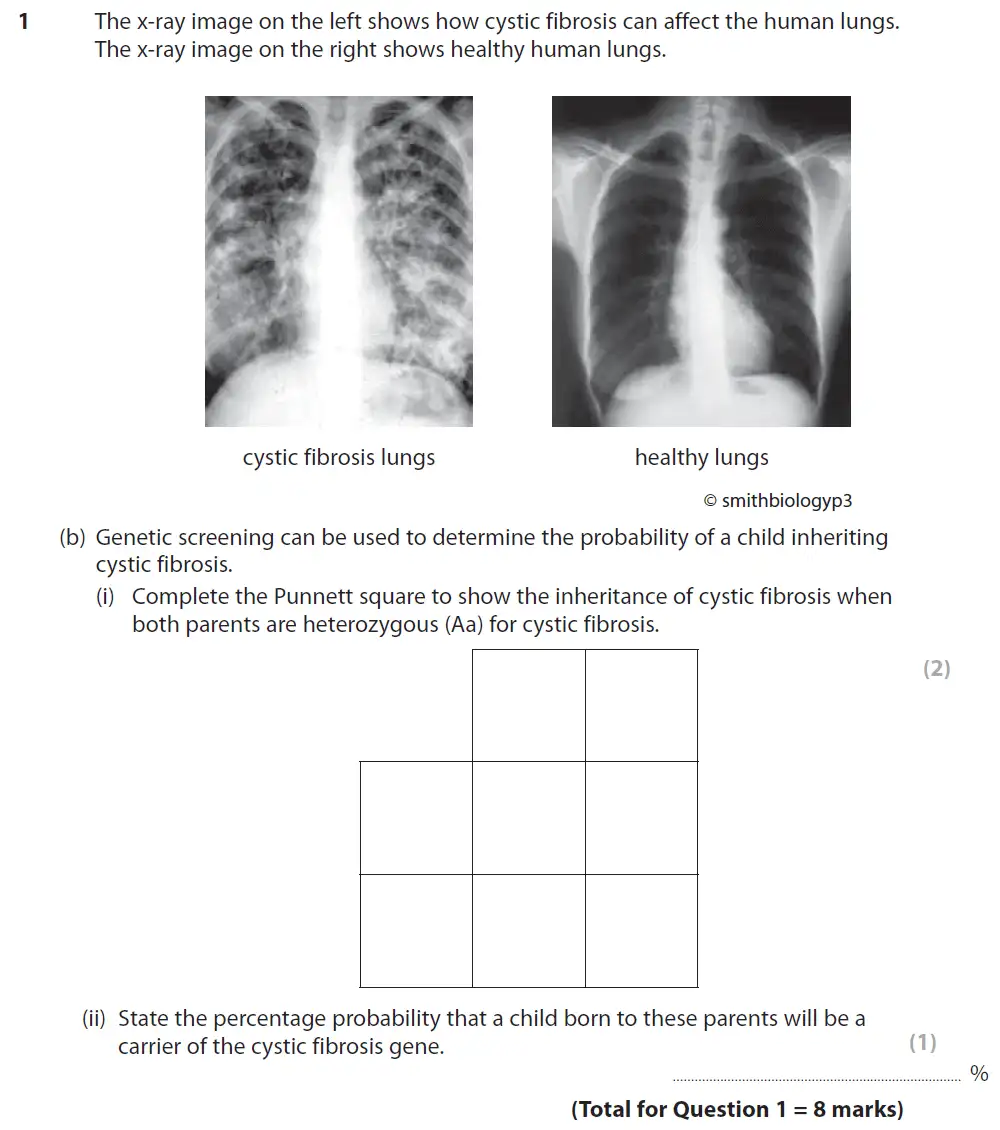 Question 4 - GCSE Edexcel Higher Biology Past Paper 1 - June 2017