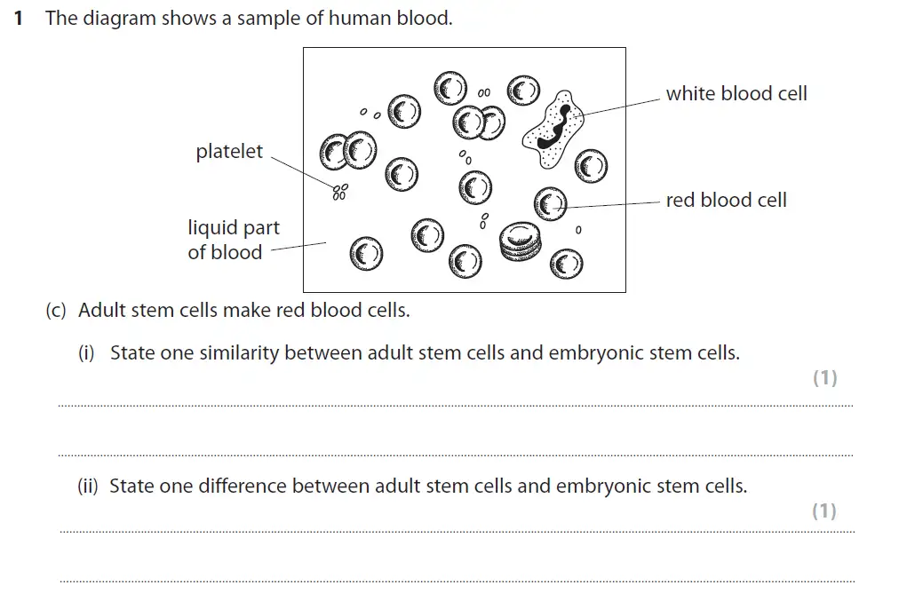 Question 4 - GCSE Edexcel Higher Biology Past Paper 2 - June 2017
