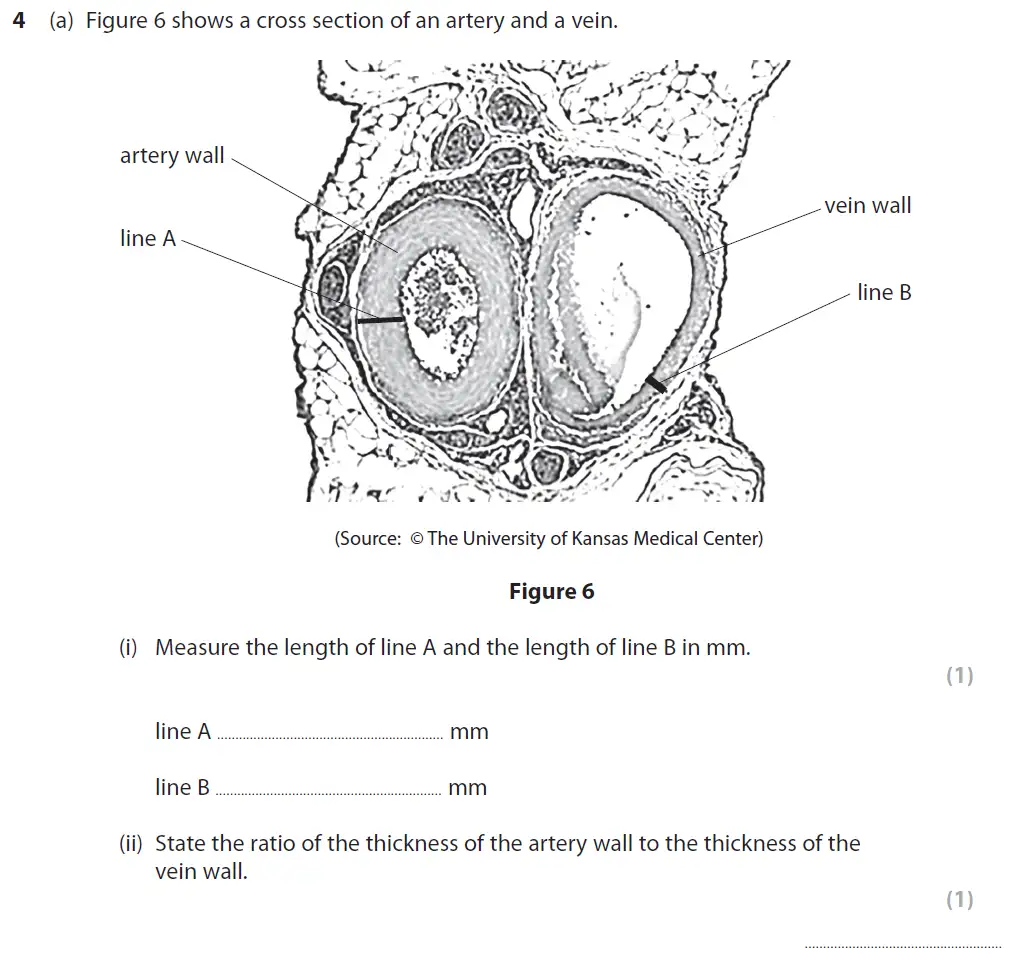Question 11 - GCSE Edexcel Foundation Biology Past Paper 2 - June 2019