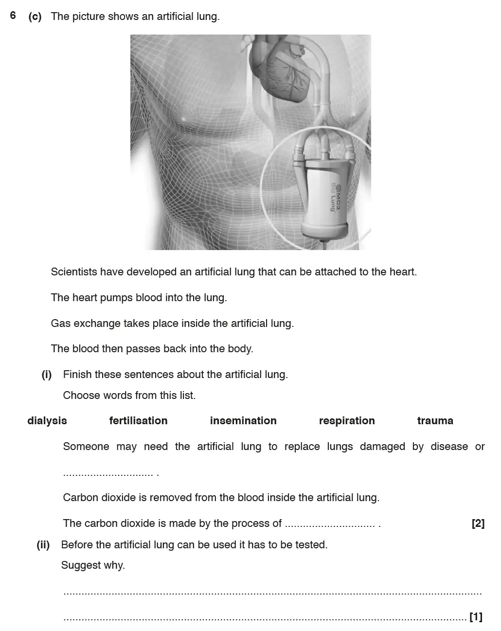 Question 15 - GCSE OCR Foundation Biology Past Paper 2 - June 2017