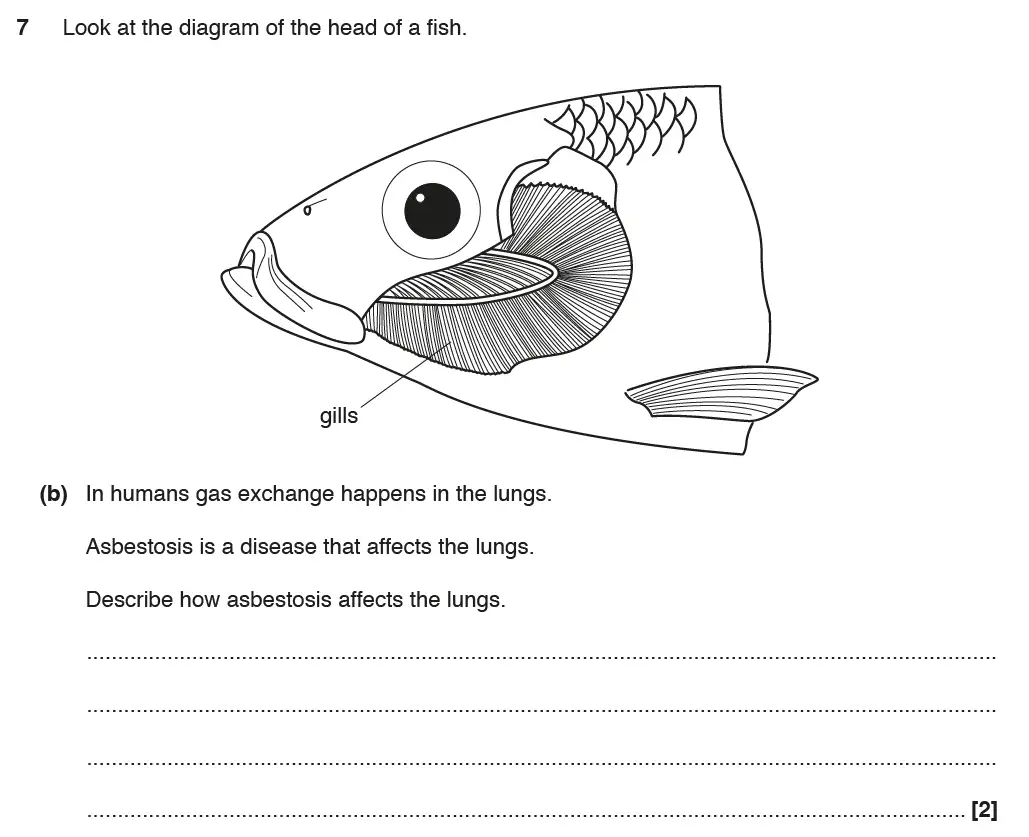Question 15 - GCSE OCR Higher Biology Past Paper 2 - June 2017